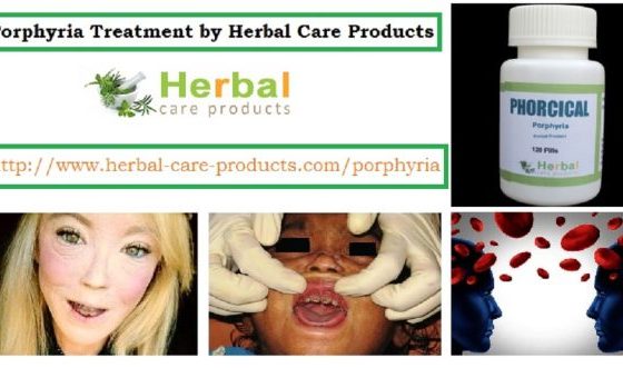 Porphyria Natural Herbal Treatment