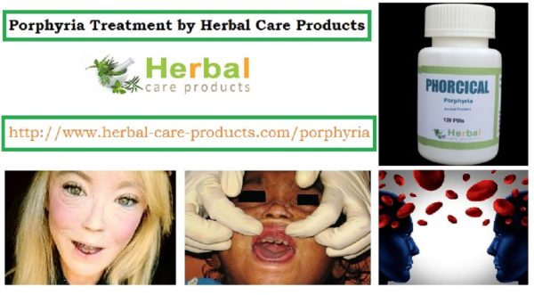 Porphyria Natural Herbal Treatment