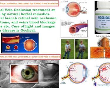 Retinal Vein Occlusion Treatment and Symptoms, Causes