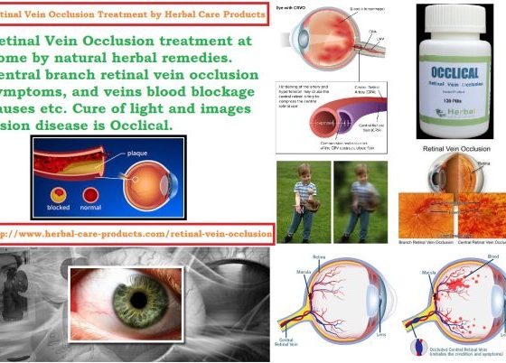 Retinal Vein Occlusion Treatment and Symptoms, Causes