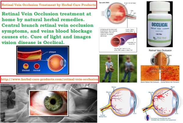 Retinal Vein Occlusion Treatment and Symptoms, Causes