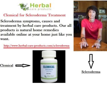 Scleroderma Treatment