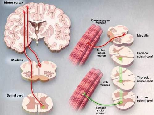 Upper Or Lower Motor Neuron Disease Symptoms, Causes And Treatment