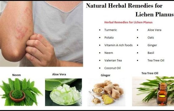 How Herbal Remedies Effective for Lichen Planus