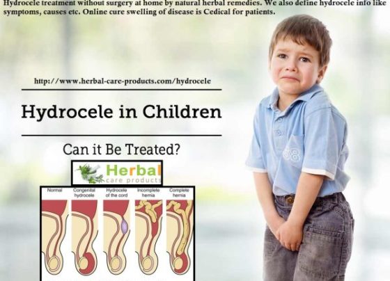 Hydrocele Natural Herbal Remedies for Pain
