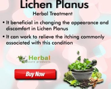Top 9 Natural Treatments for Lichen Planus