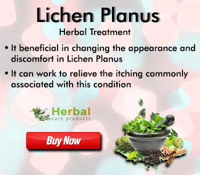 Top 9 Natural Treatments for Lichen Planus