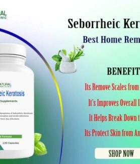 Affected with Seborrheic Keratosis Read about Home Remedies Benefits