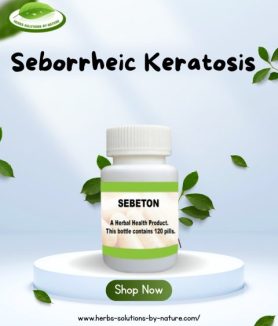 Naturally Treating Seborrheic Keratosis