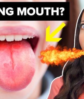 Burning Mouth Syndrome Relief How to Find Comfort and Calm Fast
