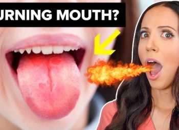 Burning Mouth Syndrome Relief How to Find Comfort and Calm Fast