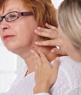 Most Effective Treatment for Actinic Keratosis