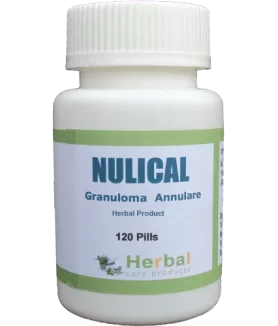 Granuloma-Annulare-Herbal-Treatment-500x500-1-1