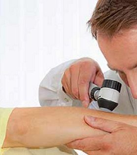 Actinic Keratosis Medical Procedures