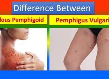 Bullous Pemphigoid and Pemphigus Vulgaris
