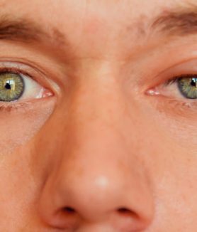 Latest Treatment for Blepharitis