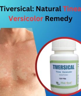 Natural Remedy for Tinea Versicolor