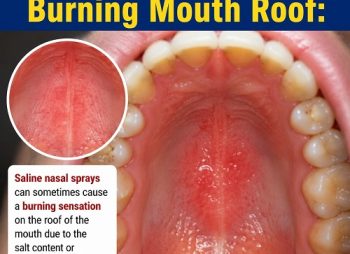 Saline Spray Burning Mouth Roof