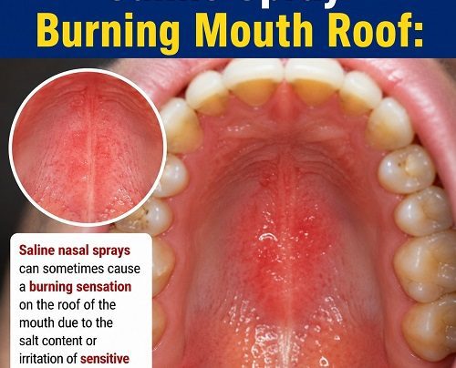 Saline Spray Burning Mouth Roof