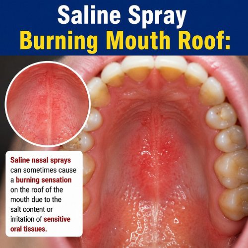 Saline Spray Burning Mouth Roof: Simple Remedies for Burning Mouth