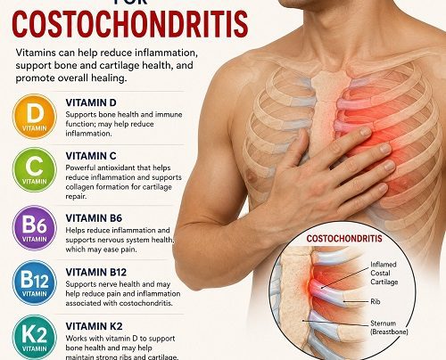 Vitamins to Take for Costochondritis