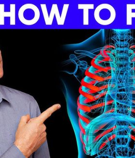 Vitamins to Take for Costochondritis