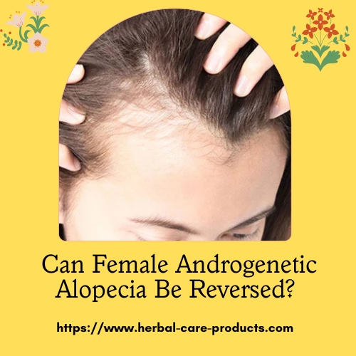 Can Female Androgenetic Alopecia Be Reversed? Understanding the Science and Solutions
