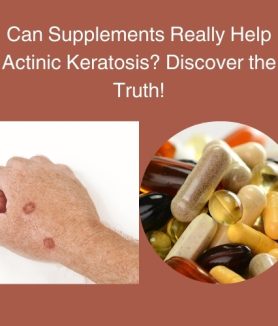 Can Supplements Really Help Actinic Keratosis