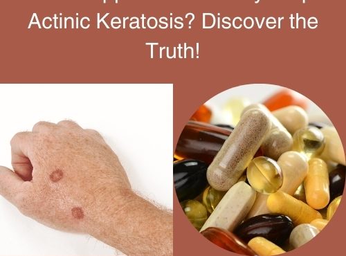 Can Supplements Really Help Actinic Keratosis