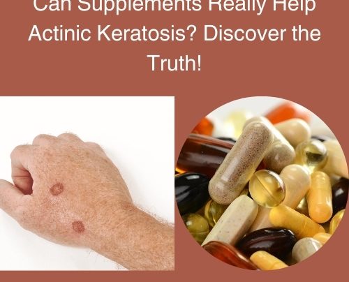 Can Supplements Really Help Actinic Keratosis