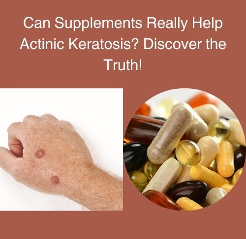Can Supplements Really Help Actinic Keratosis