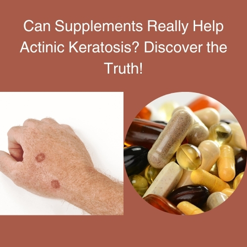 Can Supplements Really Help Actinic Keratosis? Discover the Truth!