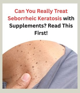 Can You Really Treat Seborrheic Keratosis