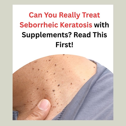 Can You Really Treat Seborrheic Keratosis with Supplements? Read This First!