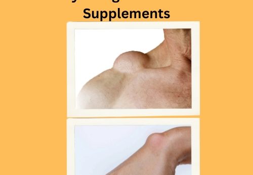 How I Shrunk My Lipomas Naturally (1)
