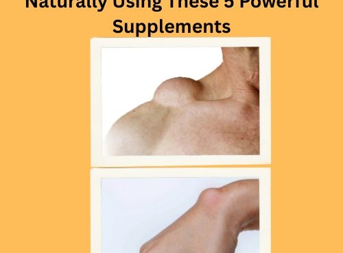 How I Shrunk My Lipomas Naturally (1)
