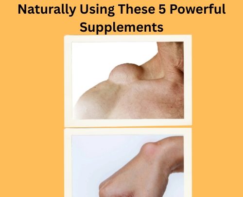 How I Shrunk My Lipomas Naturally (1)