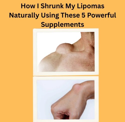 How I Shrunk My Lipomas Naturally (1)