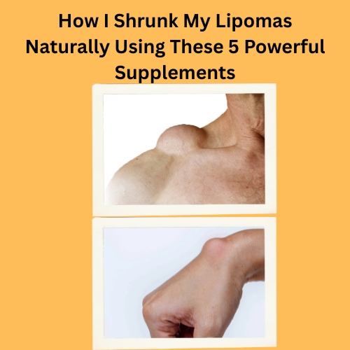 How I Shrunk My Lipomas Naturally Using These 5 Powerful Supplements