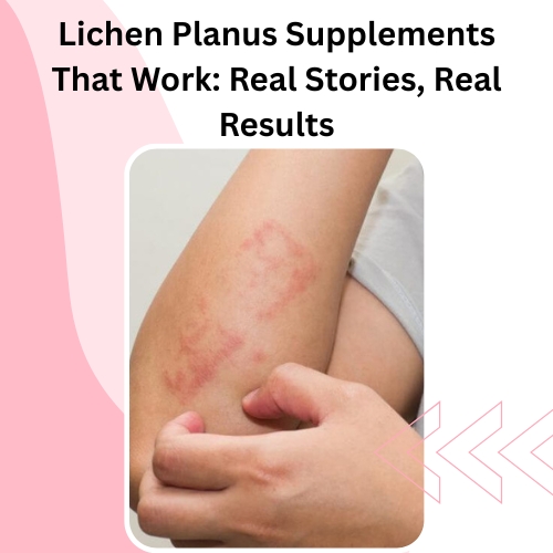 Lichen Planus Supplements That Work: Real Stories, Real Results