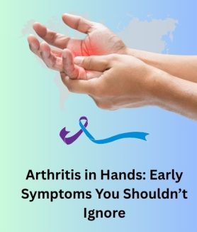 Arthritis in Hands