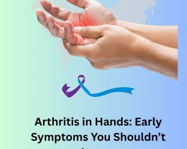 Arthritis in Hands
