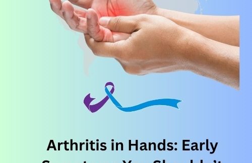 Arthritis in Hands