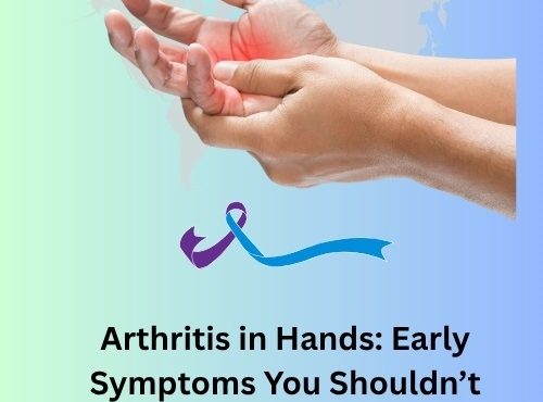 Arthritis in Hands
