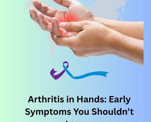 Arthritis in Hands