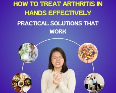 How to Treat Arthritis in Hands Effectively