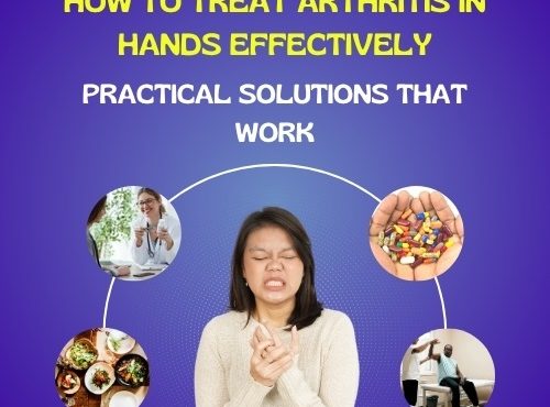 How to Treat Arthritis in Hands Effectively