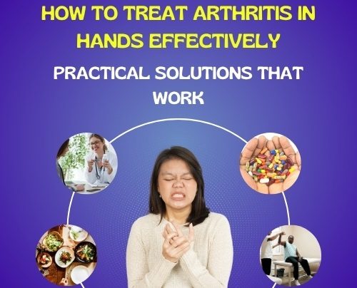 How to Treat Arthritis in Hands Effectively