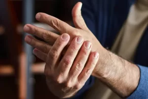 Treat Arthritis in Hands Effectively