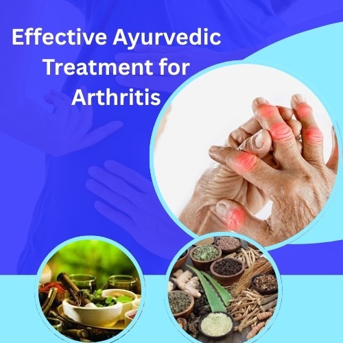 Effective Ayurvedic Treatment for Arthritis: Natural Relief That Works